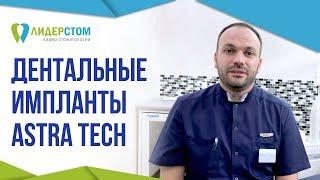 Система дентальных имплантов AstraTech  Зубной имплант Астра Теч