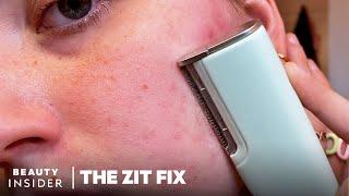 $200 Dermaplaning Device Claims To Remove Flaky Skin And Peach Fuzz  The Zit Fix