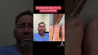 REMOVAL OF HUGE SPLINTER #shorts #splinterremoval #podiatry