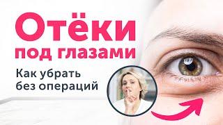 СКРЫТЫЕ причины МЕШКОВ под глазами. Как убрать без пластики?