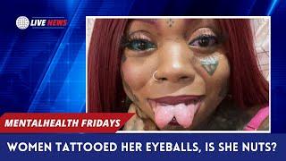 A Woman Tattooed Her Eyeballs Is It Self Hate?  Mental Health Fridays