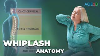 Whiplash Injury Animation  Everything You Need to Know Traumatic Brain Injury due to Whiplash