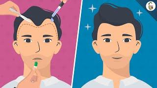 Hair Loss Treatments For Men According To Science