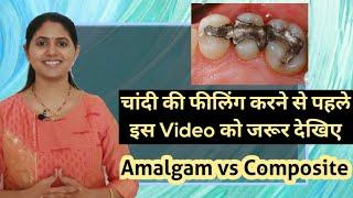 Amalgam vs Composite Filling l चांदी या  Composite कौन सा है बेहतर?