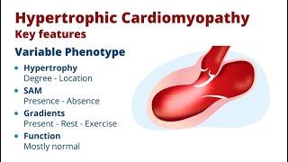 What Causes Systolic Anterior Motion of the Mitral Valve?