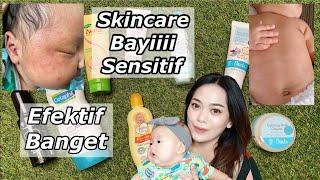 Skincare untuk Kulit Bayi Sensitif  Eksim Beruntusan Alergi pada Bayi