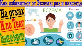 Как очистить кожу от экземы и косметических проблем Простой способ для здоровой кожи