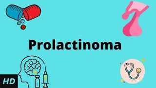 Prolactinoma Causes Signs and Symptoms Diagnosis and Treatment.