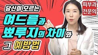 *Eng 피부트러블 - 여드름뾰루지 구별법과 예방  - 피부과전문의 닥터필러