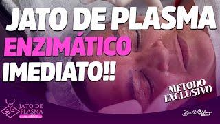 Aula de tratamento exclusivo de Jato de Plasma com Enzimas