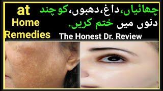 Get rid face pigmentation at home  melasma ko khatm jand dino mey  Dr review homemade...