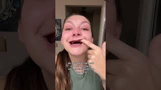 Young Woman Has Dentures