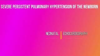 Severe PPHN