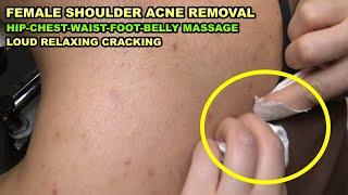 LADY AYNUR REMOVED ACNE ON LADYS SHOULDER + CRACKS + HeadFaceEarChestHipFootLegBack Massage