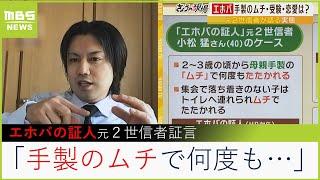 【エホバの証人】元２世信者「2～3歳から手製のムチで叩かれた」新たな『宗教２世問題』が噴出…かつての『輸血拒否』問題とは？（2023年2月28日）