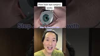 How LASIK Laser Eye Surgery Works #shorts #lasik #lasereyesurgery