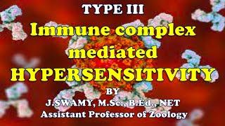 HYPERSENSITIVITY TYPE III Immune Complex Mediated Hypersensitivity