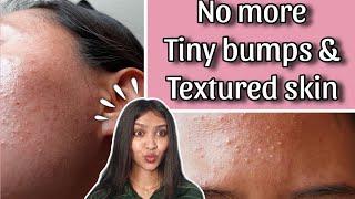 How to get rid of Tiny bumps & Textured skin  100% Solution on tiny bumps & Textured skin  