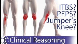 Atraumatic Knee Pain Differential Diagnosis  ITBS PFPS Jumpers Knee