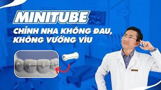 Minitube - Chỉnh Nha Không Đau Không Vướng Víu  Nam Bùi Vinalign