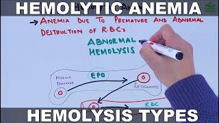 Hemolytic Anemia