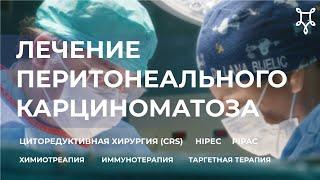 ЛЕЧЕНИЕ ПЕРИТОНЕАЛЬНОГО РАКА ЦИТОРЕКДУКТИВНАЯ ХИРУРГИЯ HIPEC PIPAC —  PERITONEAL CANCER INSTITUTE