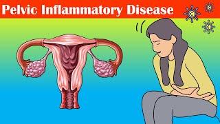 Pelvic Inflammatory Disease PID - Causes Signs & Symptoms Diagnosis And Treatment