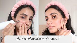 What is Microdermabrasion? How to use it?