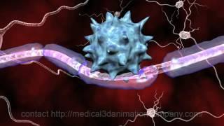 multiple sclerosis ms 3d medical animation company studio 3d visualization health care san antonio