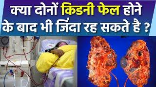 दोनों किडनी खराब होने पर जान बच सकती है कि नहीं  Dono Kidney Kharab Hone Par Kya Kare  Boldsky