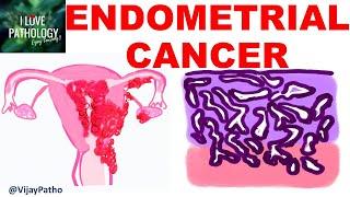 ENDOMETRIAL CARCINOMA Risk factors Etiopathogenesis Morphology & Clinical features