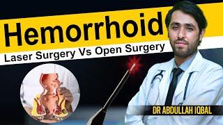 Laser vs Open Surgery For Piles in Karachi  Piles and Hemorrhoids Problem Treatment in Pakistan