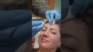 Botox ile zamanda meydan okuyun ve gençliğinizi geri kazanın #botoks #botoxtreatment