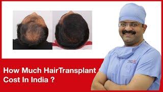 How Much Hair Transplant Cost In India  HairMD Pune