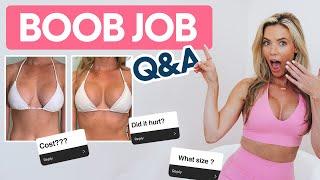 My Breast Augmentation & Lift Q&A  Everything You Need To Know