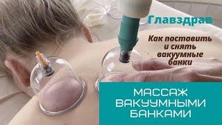 Массаж вакуумными банками. Как поставить и снять банки.