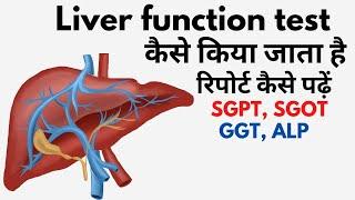 Liver function test in Hindi  lft blood test result in Hindi  lft  normal range