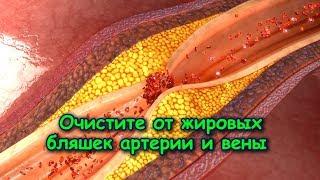 ОЧИСТИТЕ ОТ ЖИРОВЫХ БЛЯШЕК АРТЕРИИ И ВЕНЫ