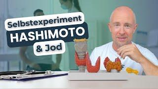 Selbstexperiment Hashimoto und Jod