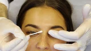 30 minute Non-Surgical Nose Job with Dr Tim  SkinViva