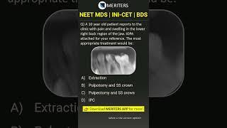 NEET MDS  INI-CET MDS  PSC  BDS - Most Important Questions  #neetmds2025 #mdsprep