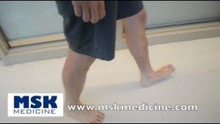 Gait Assessment