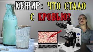 Кефир что стало с кровью под микроскопом?