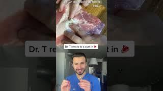 #duet with amymclendon0 cyst in meat?