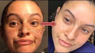 HOW TO HENNA FRECKLES
