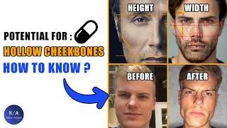 Do You Have Potential For Hollow Cheekbones ? blackpill