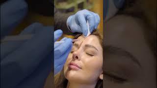 Kırışıklıklara Son Verin Botox ile Pürüzsüz Bir Cilt #botox #botoks