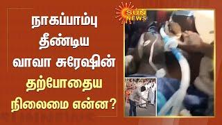 நாகப்பாம்பு தீண்டிய வாவா சுரேஷின் தற்போதைய நிலைமை என்ன?  Vava Suresh  Snake Bite  Kerala