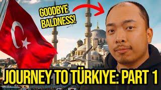 I traveled to Turkiye for a Hair Transplant