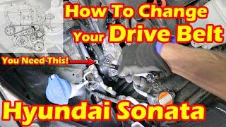 How To Change The Serpentine Belt On Your Hyundai Sonata YF – You Need This Tool